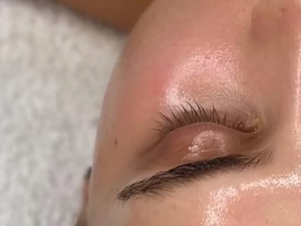 Best Facial for Dry Skin