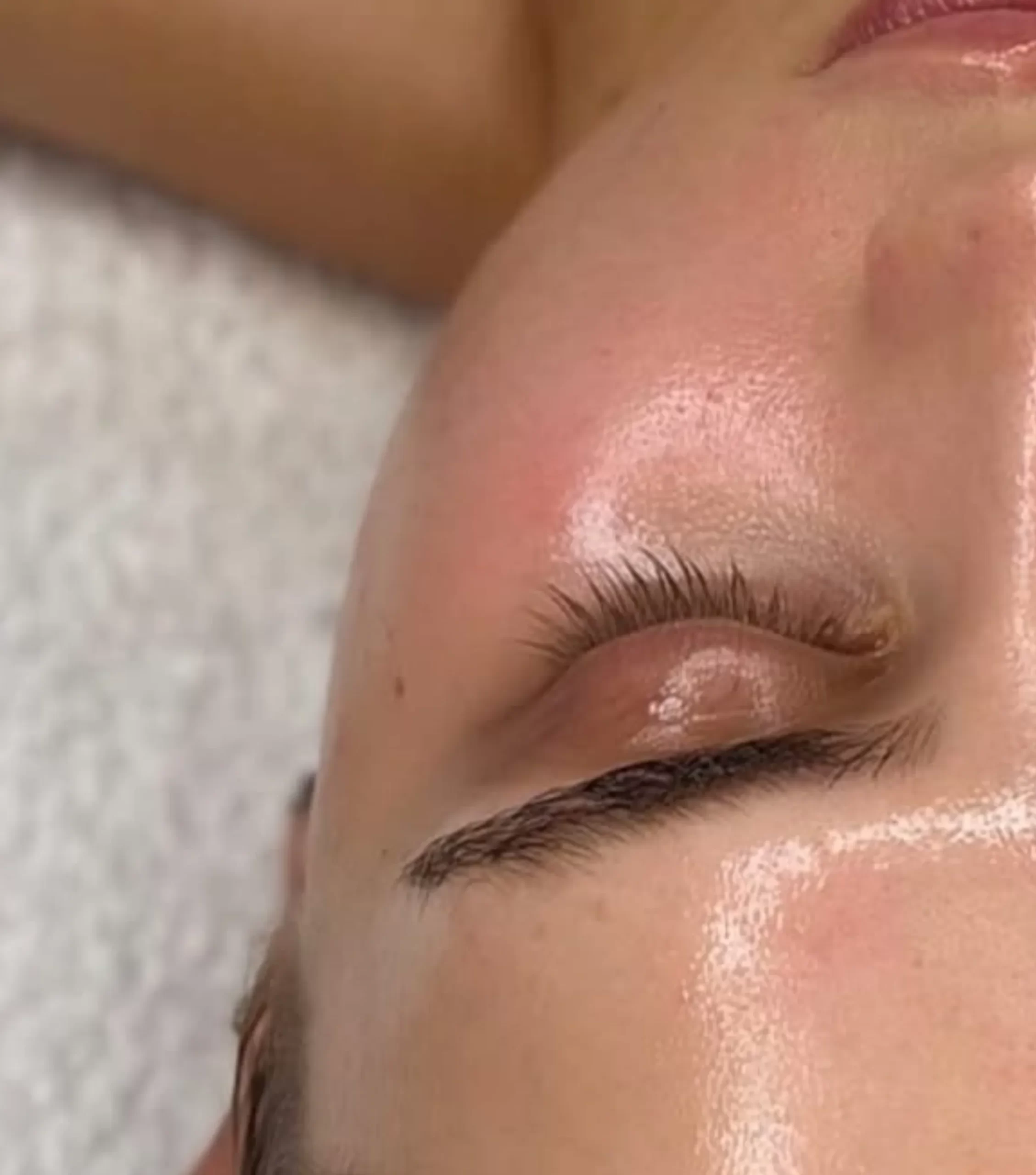 Best Facial for Dry Skin