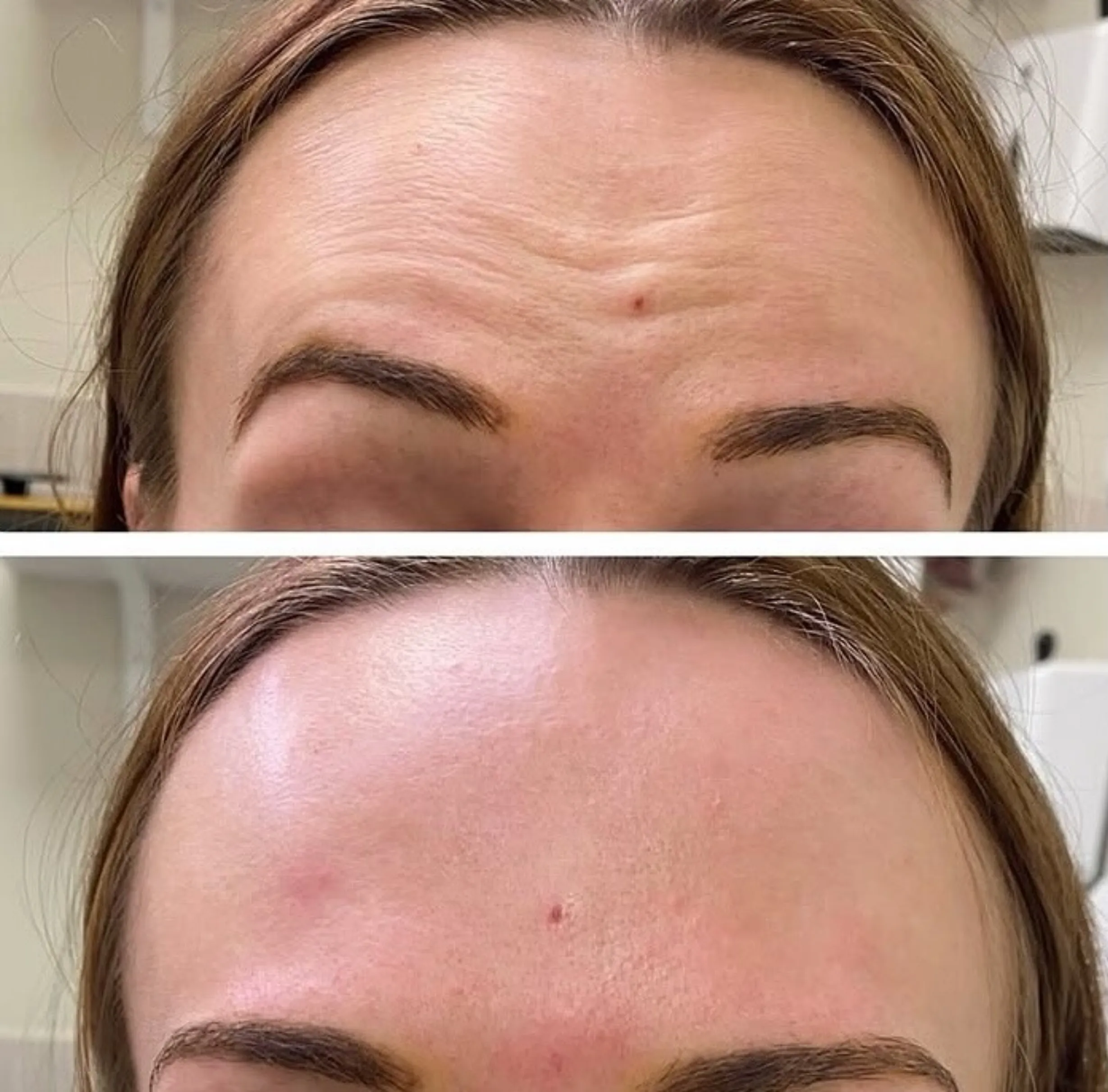 anti-aging facial treatment