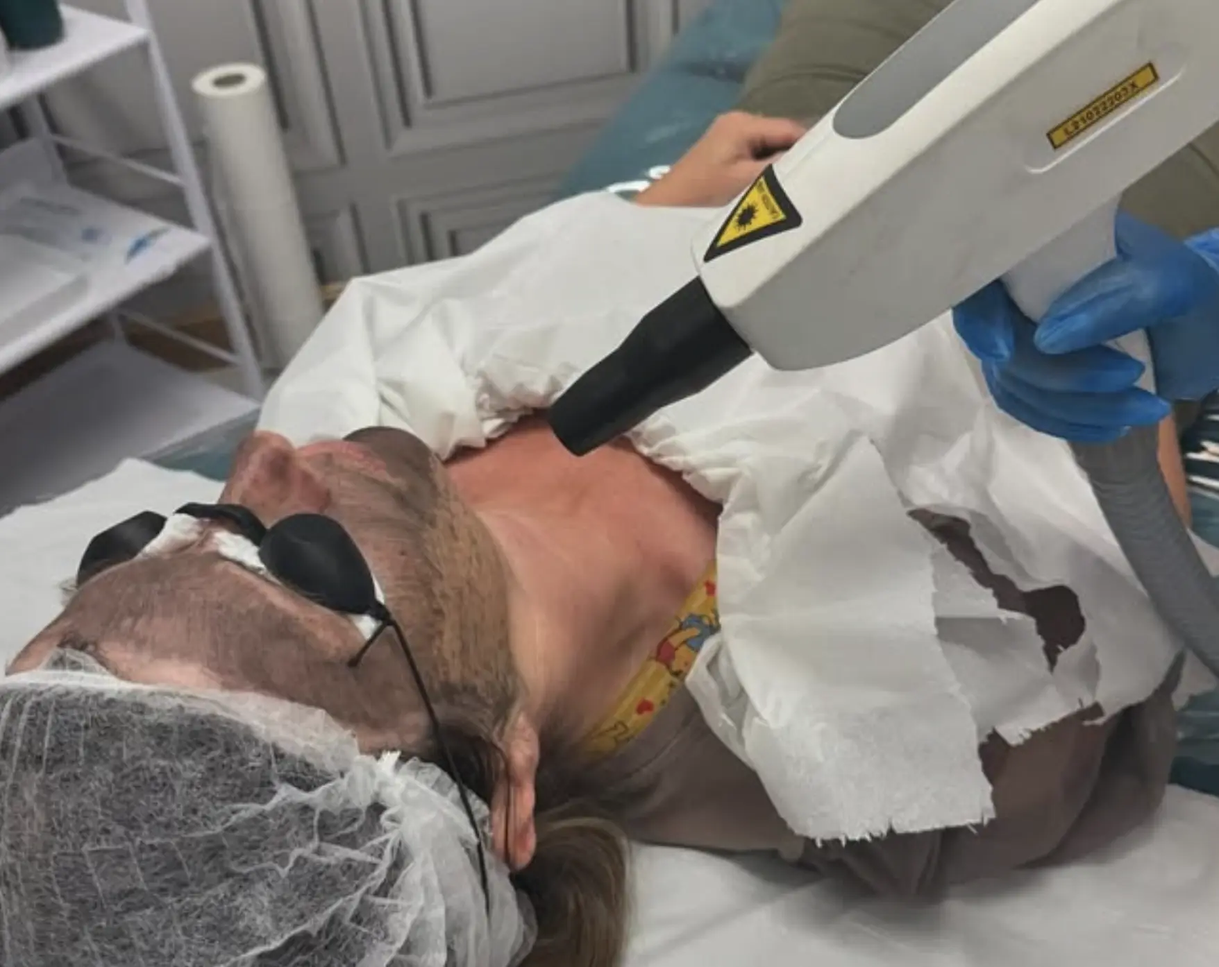 laser tattoo removal course melbourne