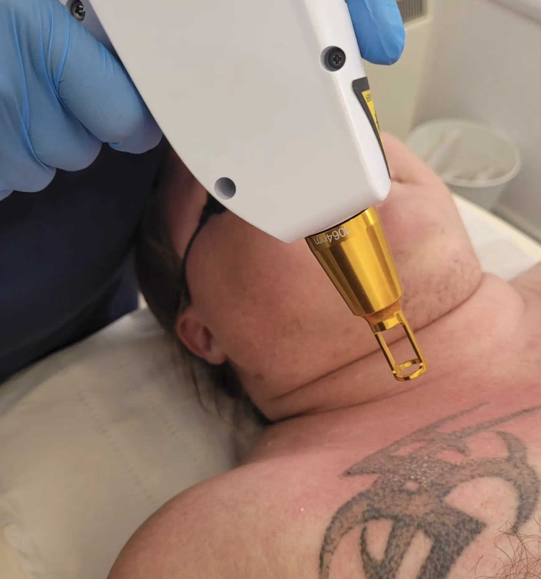 tattoo removal course price