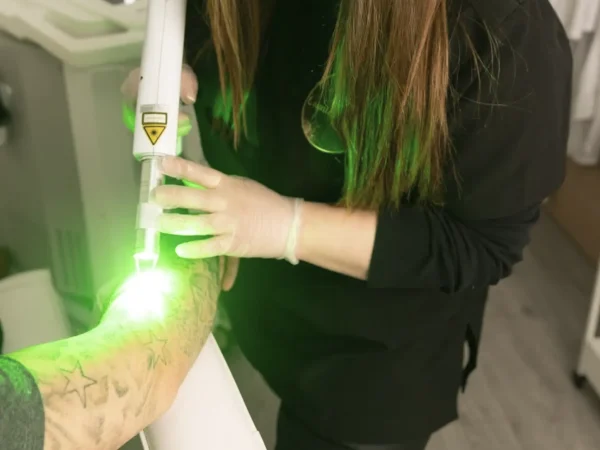 tattoo removal training near me